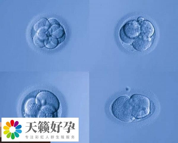 养囊可以提高试管移植成功率