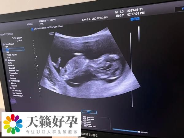冻囊胚什么时候移植好看情况，具体得看月经是否正常