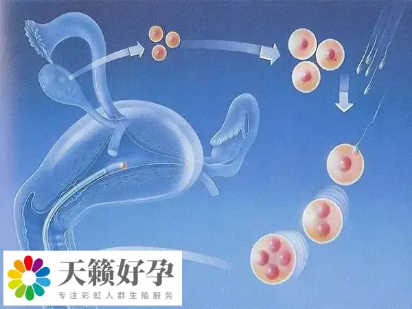 美国的试管婴儿技术目前是最好的