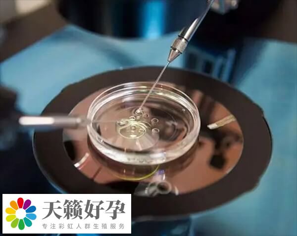 俄罗斯有三代试管胚胎全染色体筛查