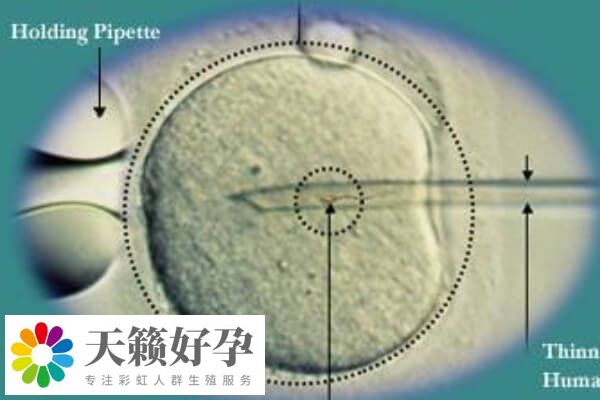 融合胚胎是一种胚胎发育的阶段