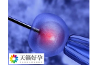 夫妻做人授失败后做试管是否要实施手术