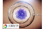 促排后fsh升高会不会是空卵泡