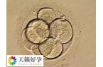 如何改善一卵多精的情况